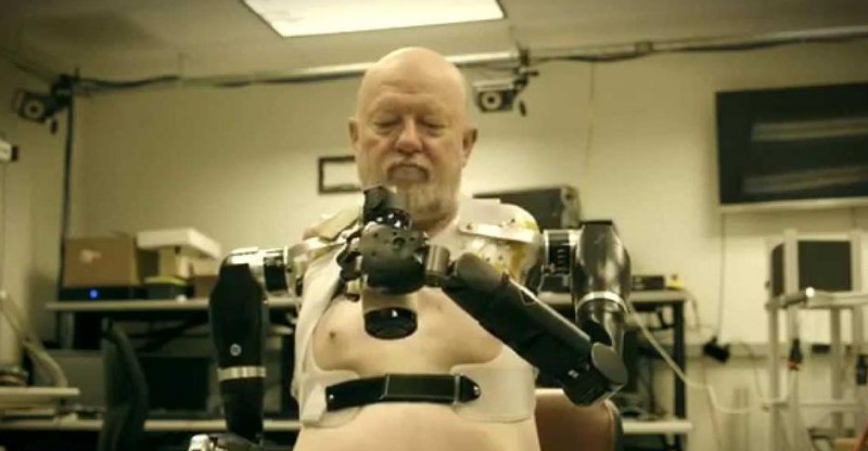 Homme sans bras contrôlant des membres bioniques