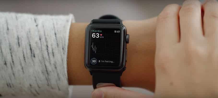 apple watch kardiaband