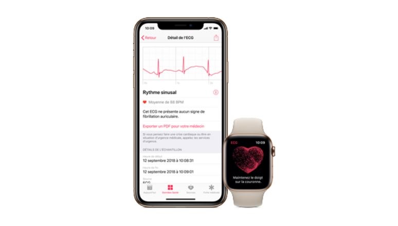 apple watch ecg app